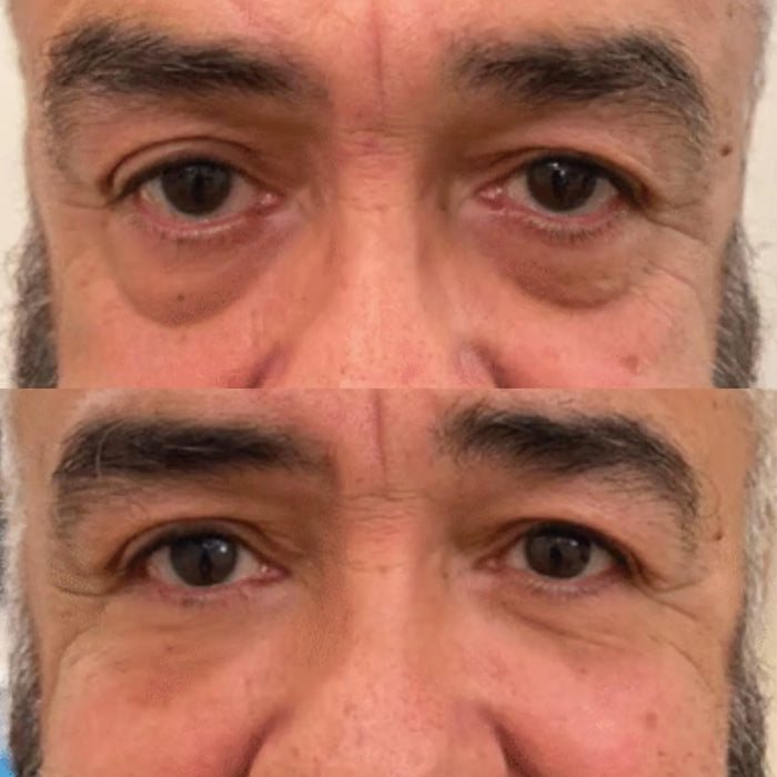 Richard H. result