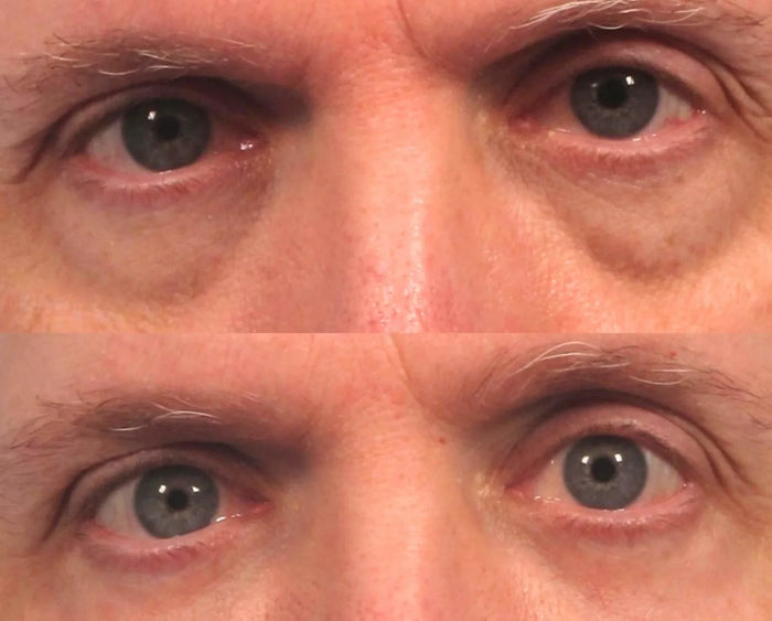 David D. result
